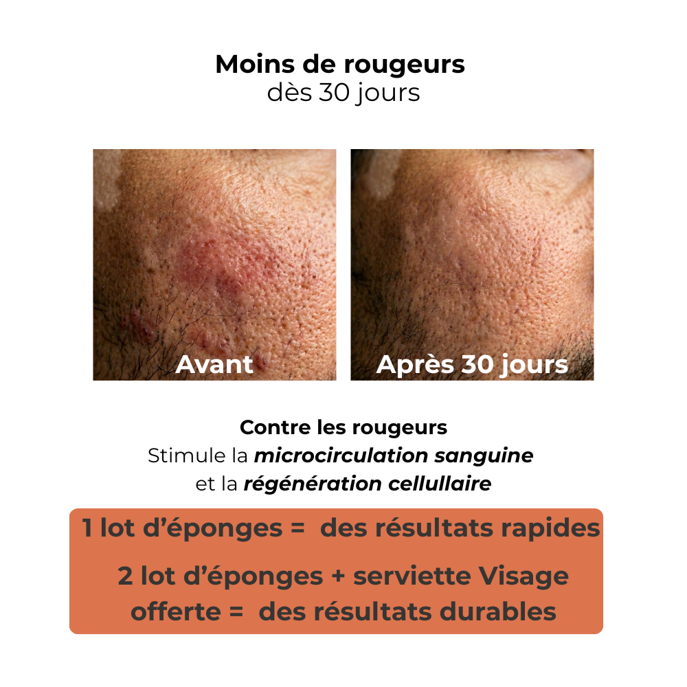 L'Éponge purifiante anti-imperfection : Le soin complet pour un Visage Pur